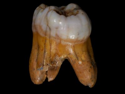 Denisovan molar